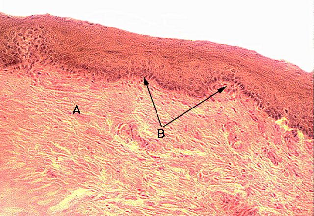 Dorsum Of Adult Tongue