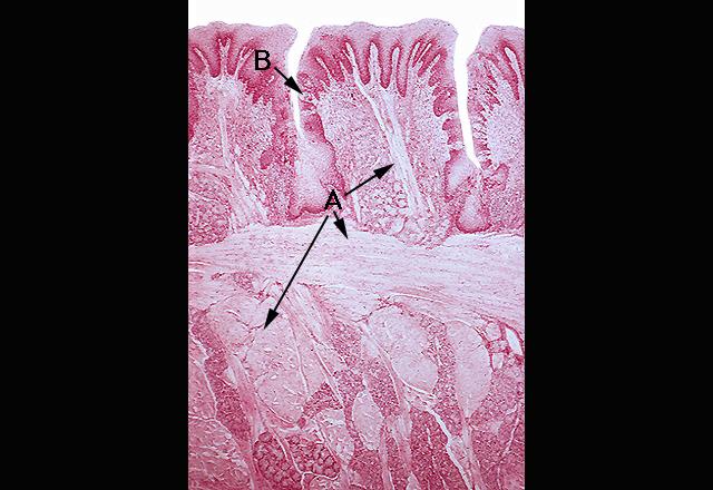 Section of Foliate Papillae