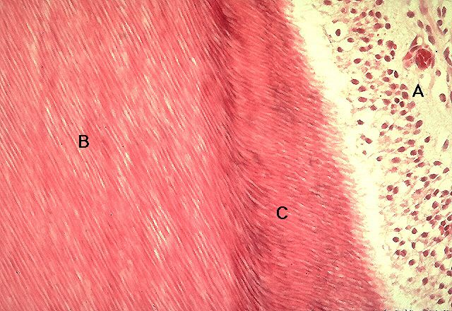 secondary-dentin