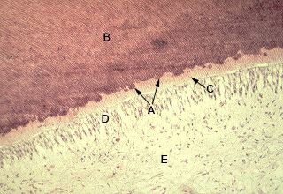 Oral Histology Digital Lab Dentin Dentin Mineralization Image 22