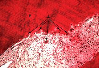 Oral Histology Digital Lab Dentin Dentin Resorption Image 40