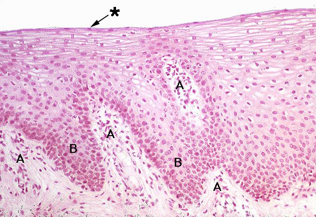 High Power of the Labial Mucosa