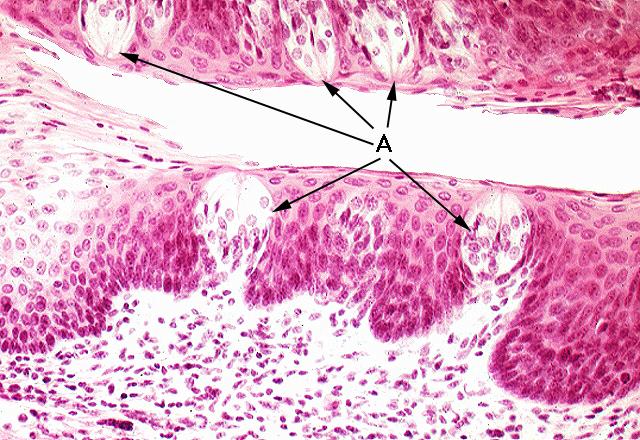 Taste Buds in Sagittal Section