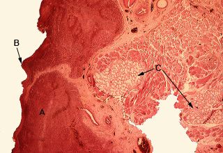 Oral Histology Digital Lab: Dental Pulp: True Pulp Stone (Image 7)