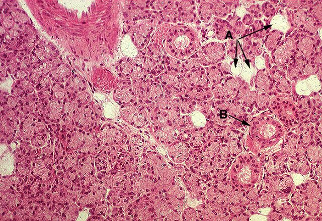 Low Power Of Parotid Gland