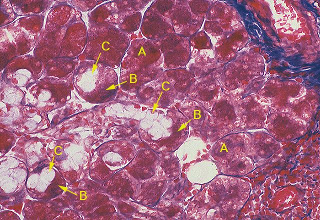 Submandibular Gland/CT Stain