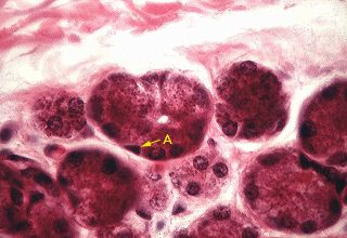 Oral Histology Digital Lab: Glands: Myoepithelial Cells (Image 4)