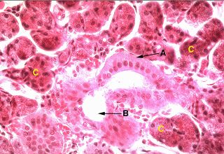 Oral Histology Digital Lab: Mucosa: Undersurface of the Tongue (Image 13)