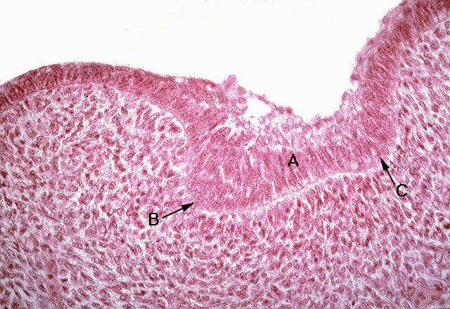 Dental and Vestibular Laminae