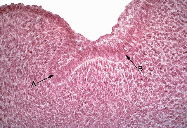 Continued Growth of the Dental Lamina