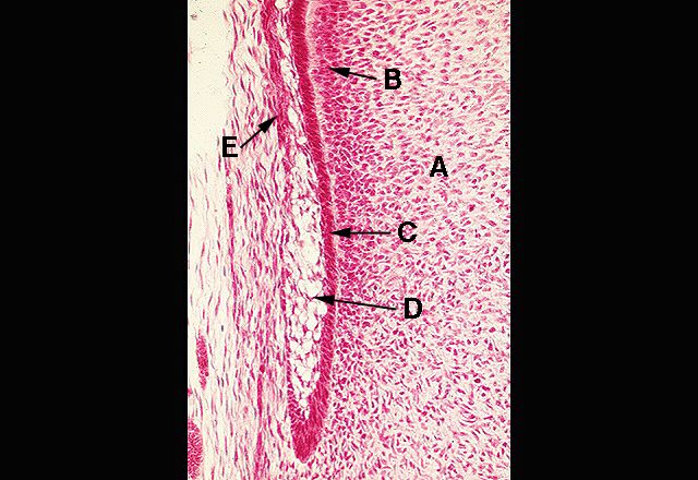 The Epithelial Root Sheath 3565