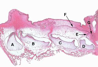 Oral Histology Digital Lab: Development: Section Through The Maxillary ...