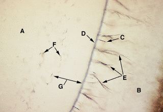 Oral Histology Digital Lab: Enamel: Enamel Tufts (Image 20)